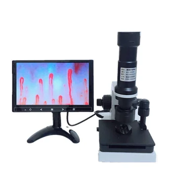 Оптовая продажа портативного светодиодного дисплея NailFold Видеокапилляроскопия Микроциркуляция Крови Капиллярный микроскоп